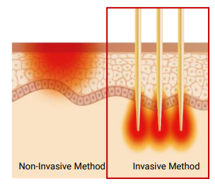 Scarlet S Özellikleri