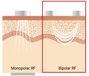 Scarlet S Avantajları