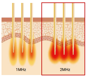 Scarlet S Kullanım Alanları