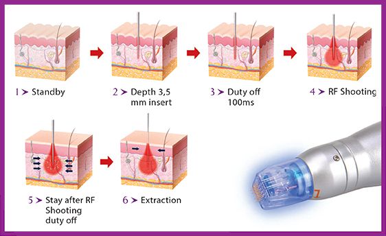Scarlet S Kullanım Alanları